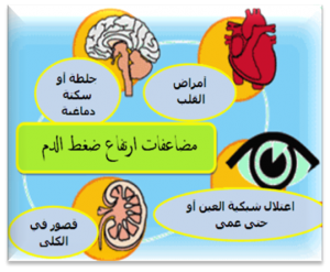 ارتفاع